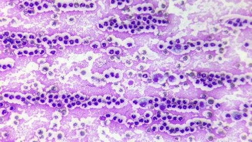 Исследование синовиальной жидкости